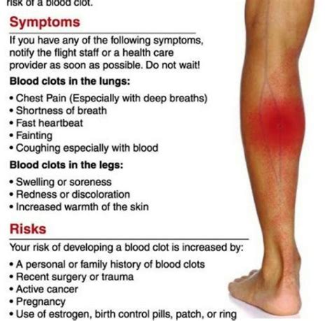 Signs of Blood Clot in Leg: Visible and Invisible Clues .
